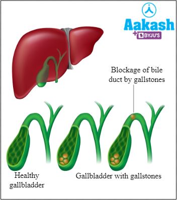 Liver: Location, Structure, Duct system, Functions, Common Disorders ...